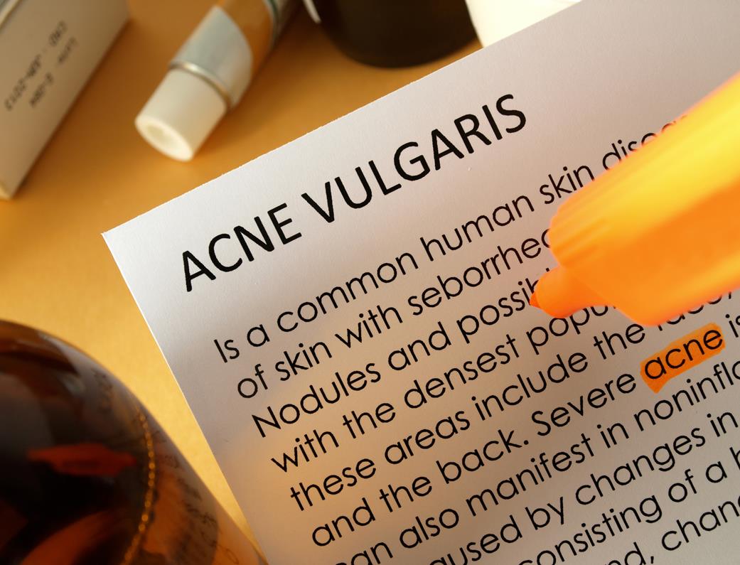 Akne vulgaris